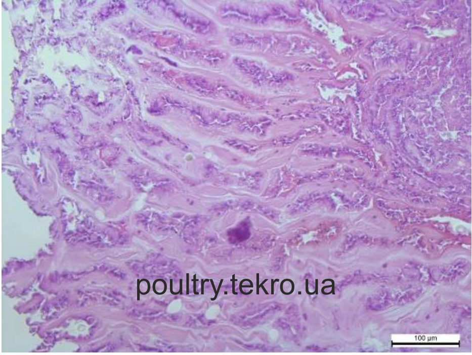 Некроз перехідної ділянки слизової оболонки залозистого шлунка Гематоксилін та еозин. х 400
